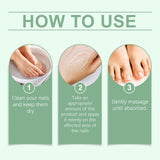 Nail Fungal Treatment Ointment Anti Infection Paronychia Onychomycosis Soft Hand Feet Toenail Repair Damaged Health Care Cream