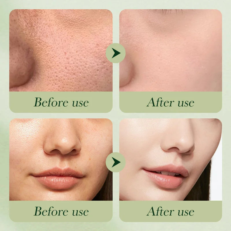 Avocado Skincare 6-Piece Set Includes Nourishing And Moisturizing Eye Cream, Face Cream, And Anti-Wrinkle Skincare Products.