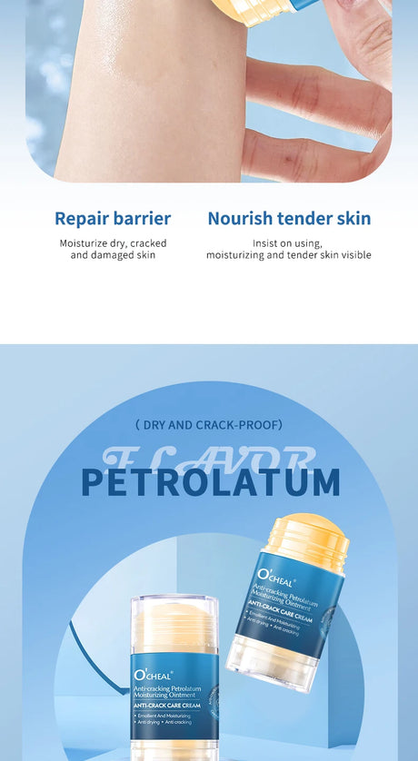 Anti Crack Foot Cream For Dry And Cracked Feet And Heels, Moisturizing Dry Feet And Heels, Preventing Your Feet From Cracking