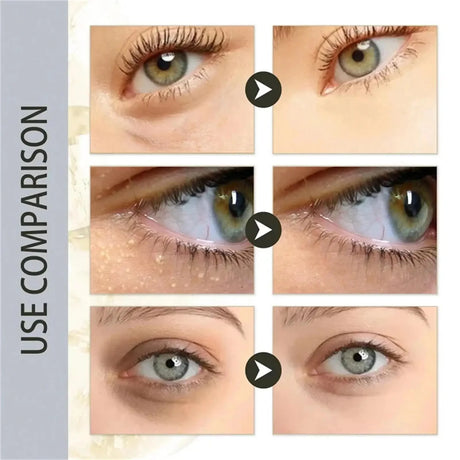 Remove Eye Fat Particles Serum Milia Treatment Products Anti Puffiness Anti Inflammatory Repair Skin Barrier Korean Skin Care