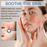 Facial Redness Repair Cream Improve Sensitive Skin Dryness Hydrating Sooth Lotion Removal Rosacea Day Night Korean Cosmetics