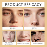 Black & White Rice Exfoliating Serum Set BHA Niacinamide Pore Minimizing & Brightening Blackhead Whitehead Remover Skincare Set