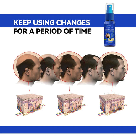 Ginger Hair Growth spray Anti  Fall  Loss Treatment   Essence Oil for Men Women hair treatment