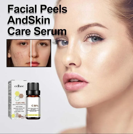 High Quality 50% Chemical Peel Acid Skin Superforce Pigmentation Lightening Melanin Acne Treatment Remove Scar
