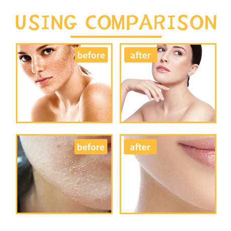 Turmeric Body Scrub - Cleanses Skin's Dead Cells, Leaving Skin Smooth And Soft. Skin Cleansing And Exfoliating Scrub.