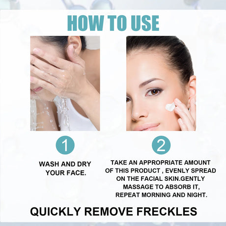 Freckle Whitening Cream Nicotinamide Fade Dark Spot Blemish Acne Mark Brightening Lightening Pigmentation Correction Cream