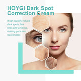 Powerful Spot-removing Whitening Freckles Cream Remove Melasma Dark Spots Fade Pigmentation Acne Moisturizing Brighten Skin Care