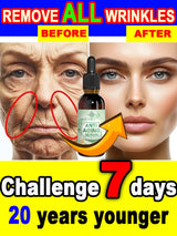 wrinkles disappeared