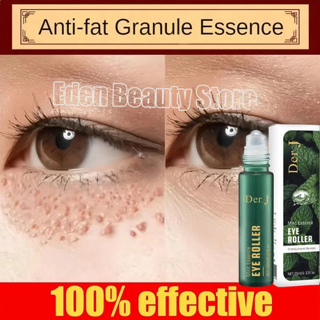 Remove Eye Fat Particles Serum Milia Treatment Products Anti Puffiness Anti Inflammatory Repair Skin Barrier Korean Skin Care