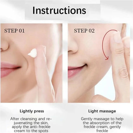 Powerful Spot-Removing Whiten Cream Brighten Skin Fast Eliminates Melanin Pigmentation Melasma Dark Spots Korean Face Skin Care