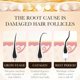 Biotin fast Hair Growth oil Products Care Scalp Massage Treatments Anti Hair Loss Effective Grow Thicker Hair serum for men