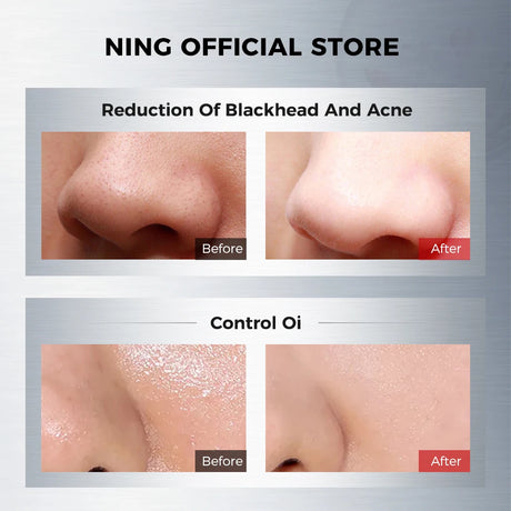 NING Amino Acid Facial Cleanser – Gentle, Hydrating Deep Cleansing Face Wash for Sensitive Skin