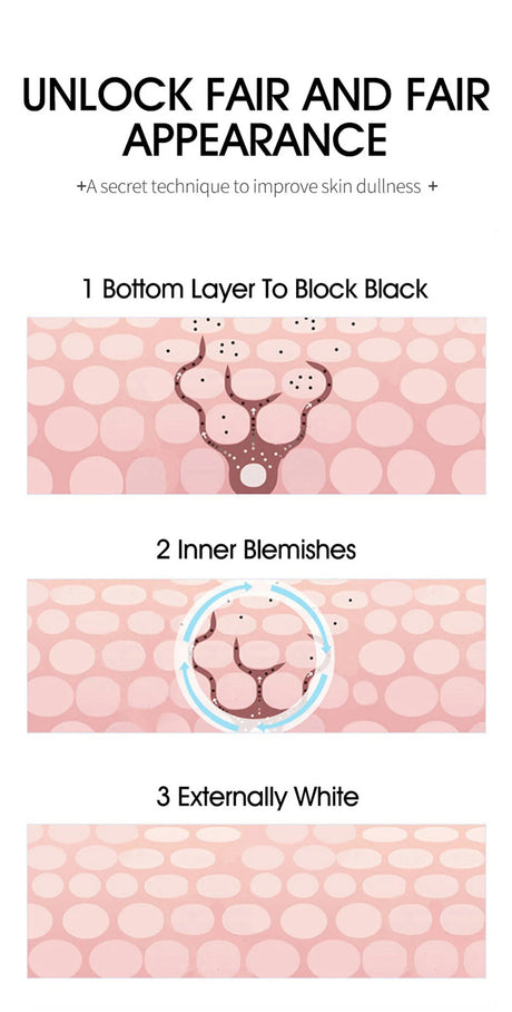 Powerful Spot-Removing Whiten Cream Brighten Skin Fast Eliminates Melanin Pigmentation Melasma Dark Spots Korean Face Skin Care