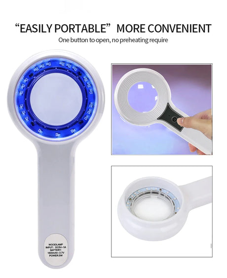 NEW Professional Dermatoscope Skin Medical Magnifier Detection Woods Lamp UVA Lamp For Vitiligo Detection