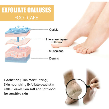 Ouhoe Foot Exfoliating Spray 72H Moisture Lock Callus Softener Anti Dry Crack Repair Odor Control Brightening Foot Care Liquid