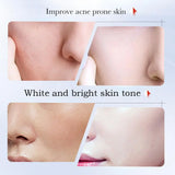 SADDER Kojic Acid Face Cream for Dark Spots Freckles Skin Care with Vitamin C, Whitening Treatment, Overnight Repair Moisturizer