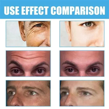 Retinol Eye Bag Removal Cream For Men Anti-Wrinkle Firming Skin Fades Fine Lines Anti Dark Circle Puffiness Brightening Eye Care
