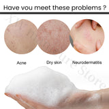 Whitening Shower Gel Deep Cleansing Exfoliation Removes Melanin Moisturizing Repair Lotion Brightens Skin Shower Gel Care 400g