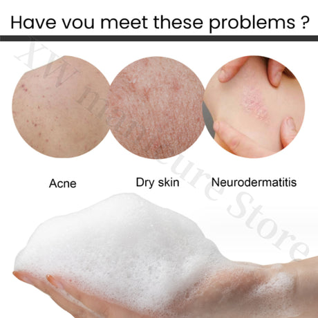 Whitening Shower Gel Deep Cleansing Exfoliation Removes Melanin Moisturizing Repair Lotion Brightens Skin Shower Gel Care 400g
