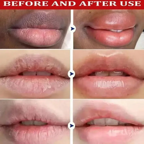 Remove Dark Lip Scrub Fast Lightening Pink Lip Exfoliating Fade Lip Line Dead Skin Moisturizer Korean Care Products Beauty Healt