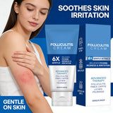 Folliculitis Cream Reduce Redness Relieve Itching Soothing Stimulating Herbal Gentle Smoothing Nourishing Care Cream