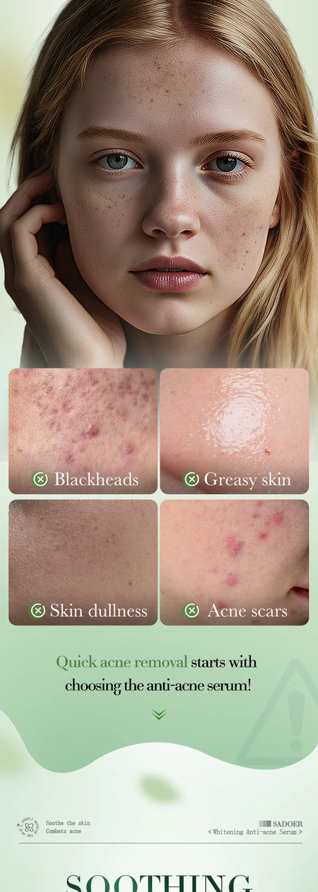 SADOER Salicylic Acid Nicotinamide Whitening Face Serum Acne Removing Moisturizing Anti Wrinkles Facial Essence Skin Care