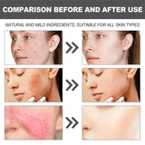 B5 Repair Cream Moisturizing Hydrating Effectively Solves Dry Chapped And Red Skin Nourishes Improve Repair Sunscreen Cream