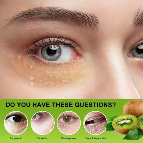 Remove Eye Fat Particles Serum Milia Treatment Products Anti Puffiness Anti Inflammatory Repair Skin Barrier Korean Skin Care
