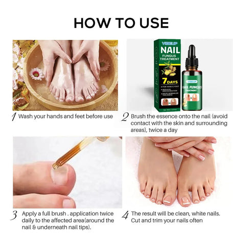 7 Days Nail Fungus Treatment Serum Ginger Anti-infective Paronychia Onychomycosis Toe Foot Nail Fungal Repair Gel Hand Foot Care