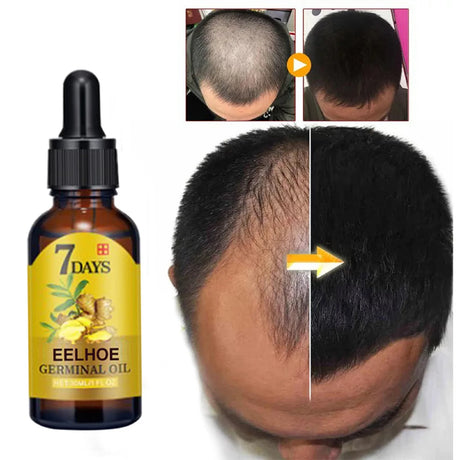EELHOE 20ml Ginger Hair Growth Oil Strengthening Scalp Nourishing Hair Roots Anti Loss Fuller Care Hairs Essence for Women Men