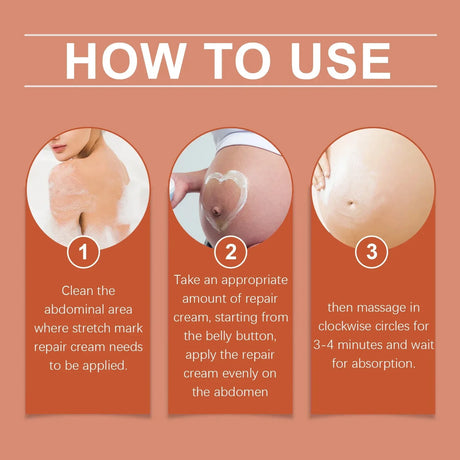 Cream For Pregnancy Stretch Marks Removal Eliminate Red White Old Stretch Marks  2025