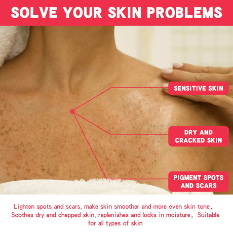 Lightening Body Cream Remove Dark Spots Melanin Bleaching Elbow Armpit Leg Knee Hips Thigh Moisturizing Whitening Underarm Stick