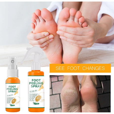 Herbal Anti Crack Foot Cream Spray Heel Cracking Repair Products Exfoliation Dead Skin Removal Softening Moisturize Smooth Care