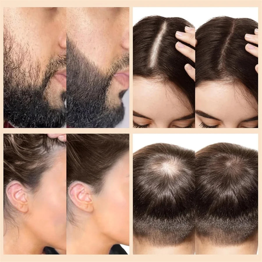 GOIPLE Hair Fiber Hold Spray Instant Volumizing Product Hair Building Fibers Powder Hairstyle Thickening Spray for Men and Women