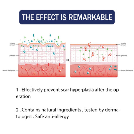 EELHOE Silicone Skin Scar Gel Retinol Niacinamide Scars Stretch Marks Burn Marks Deeply Nourish Skin Reduce Redness Swelling 30g