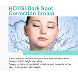 Powerful Spot-removing Whitening Freckles Cream Remove Melasma Dark Spots Fade Pigmentation Acne Moisturizing Brighten Skin Care