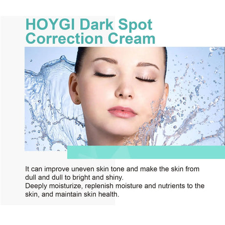 Powerful Spot-removing Whitening Freckles Cream Remove Melasma Dark Spots Fade Pigmentation Acne Moisturizing Brighten Skin Care