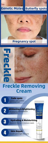 Dark Spot Remover for Face Removing Freckle Chloasma Senile Plaques Sunburn Cyasma Chorioplaque Freckle Cream