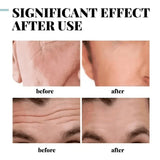 Retinol Eye Bag Removal Cream For Men Anti-Wrinkle Firming Skin Fades Fine Lines Anti Dark Circle Puffiness Brightening Eye Care