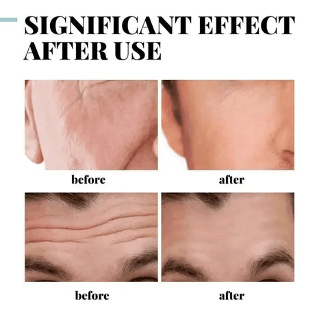 Retinol Eye Bag Removal Cream For Men Anti-Wrinkle Firming Skin Fades Fine Lines Anti Dark Circle Puffiness Brightening Eye Care