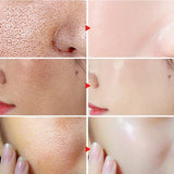 Facial Redness Repair Cream Improve Sensitive Skin Dryness Moisturizer Hydrating Sooth Lotion Removal Rosacea Korean Cosmetics