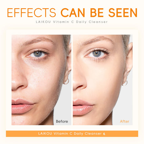 LAIKOU Vitamin C Daily Cleanser Brightening Face Wash Deep Cleansing Moisturizing Skin Tone Even Treatment