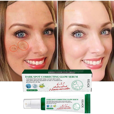 Dark Spot Correcting Glow Serum,Dullness,Acne,And Melanin Remover,Niacinamide Facial Skin Moisturizing Brightening Skincare