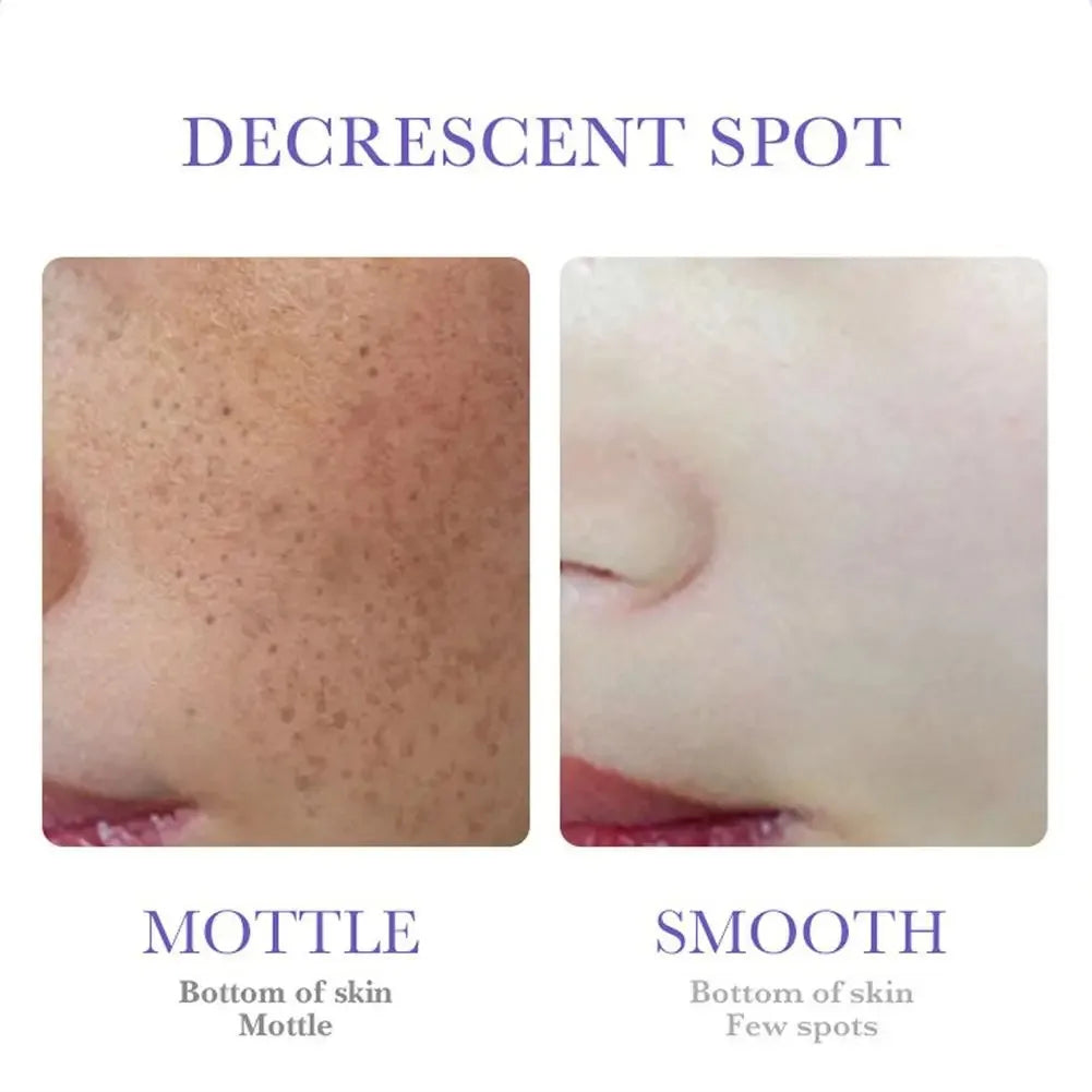SADOER Nicotinamide Remove Melasma Dark Spot Whiten Freckle Cream Lighten Melanin Brightens Skin Tone Moisturize Face Skin Care