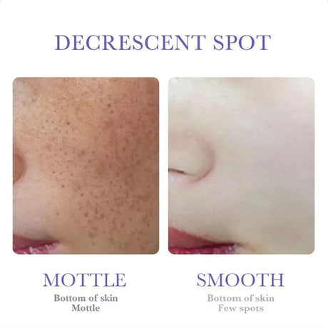SADOER Nicotinamide Remove Melasma Dark Spot Whiten Freckle Cream Lighten Melanin Brightens Skin Tone Moisturize Face Skin Care