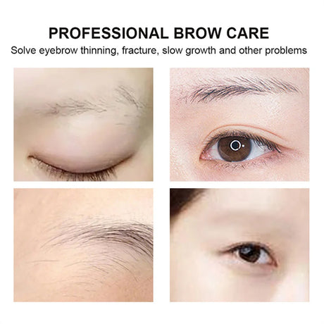Eyelash & Eyebrow Growth Serum – Prevents breakage, delivers fuller results in 7 days, ideal for daily eye care.