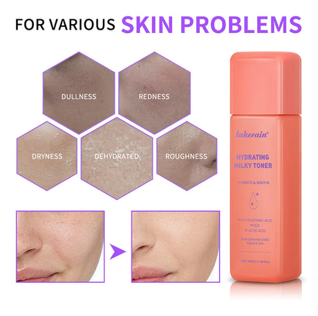 Hydrating Milky Toner Repair Skin Ultra Hydrating Toner for Face Soothes Skin Moisture Reduces Redness Barrier Skincare
