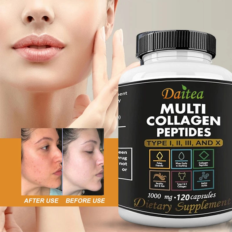 High Strength Multi-Collagen Complex Capsules – Hydrolyzed Peptides for Skin, Hair, Nails & Joints – Grass-Fed, Non-GMO