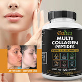 High Strength Multi-Collagen Complex Capsules – Hydrolyzed Peptides for Skin, Hair, Nails & Joints – Grass-Fed, Non-GMO