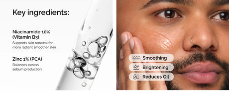 10% Niacinamide 1% Zinc Face Serum 30ml, Oil Control Pore Minimizer, Anti-Acne Dark Spot, Gentle Skin Care for All Skin Types
